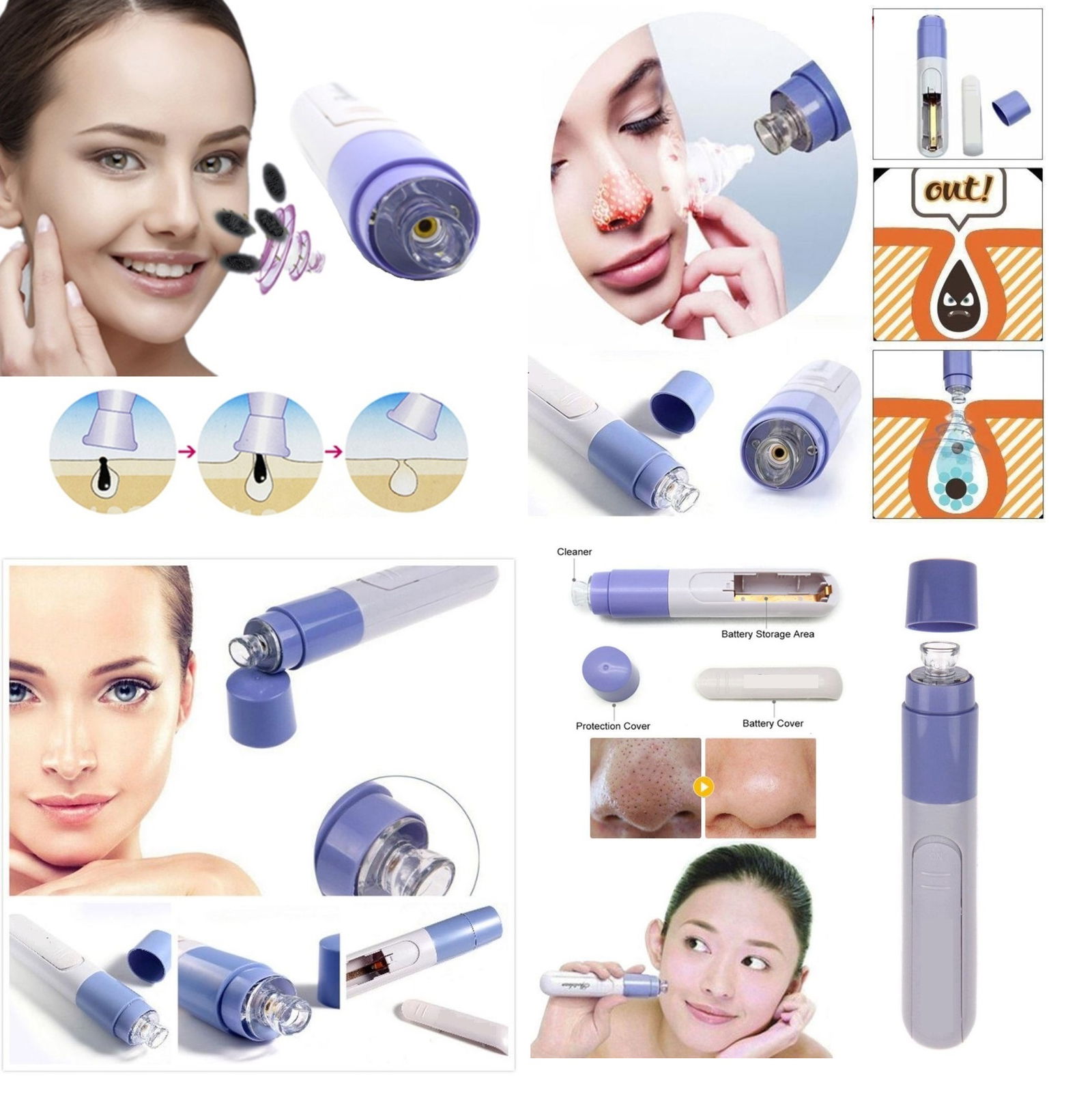 Blackhead Removal - Facial Cleansing Device Vacuum Blackhead Removal Device