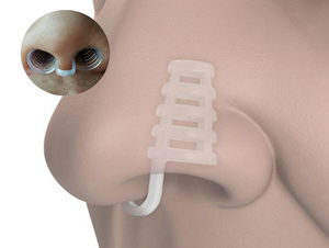 Snoring Nasal Apparatus - Caged