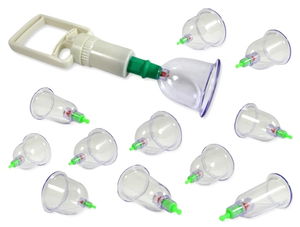 Vacuum Cupping Set (12 Pieces)