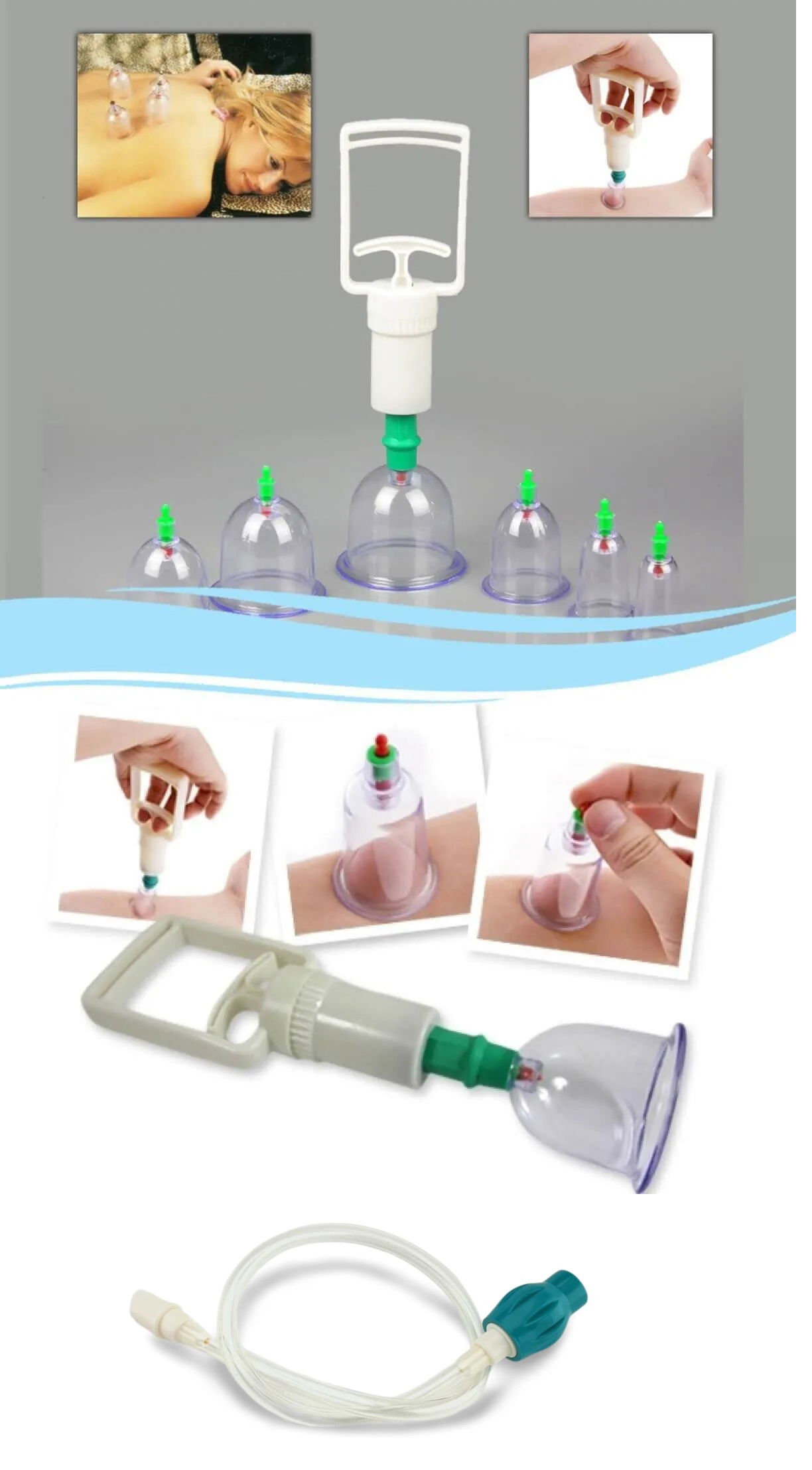 Cupping Set with Hose - Cupping Set with Vacuum Hose (Model 1)