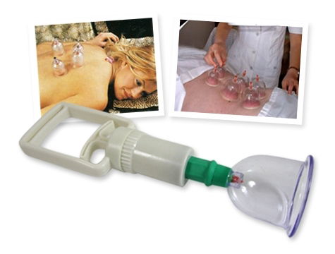 Vacuum Cupping Set (12 Pieces)