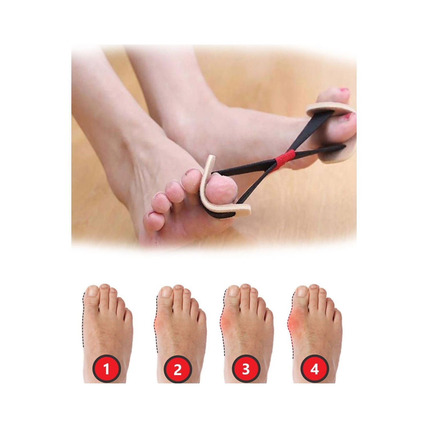 Foot Thumb Bone Corrector Exercise Tire