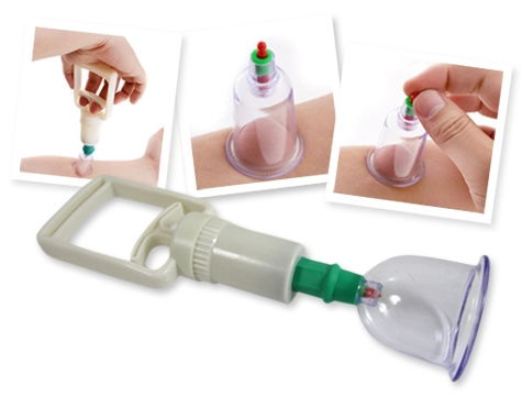 Vacuum Cupping Set (12 Pieces)