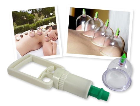 Vacuum Cupping Set (12 Pieces)