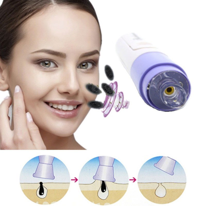 Blackhead Removal - Facial Cleansing Device Vacuum Blackhead Removal Device